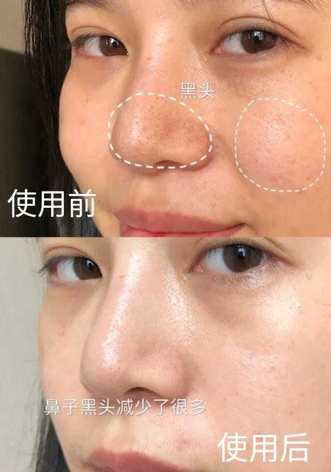 @知书先生粉丝 | HFP内购福利,限量开抢!